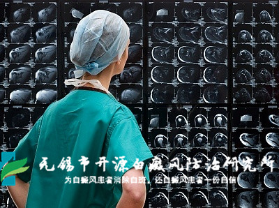 徐州白癜风医院 徐州白癜风医院