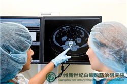 如何辨别白斑与白癜风