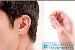 面部白癜风治疗方法?