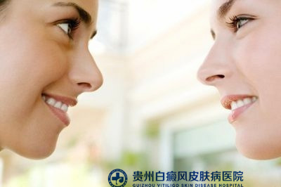 白癜风的发病原因 白癜风的发病原因
