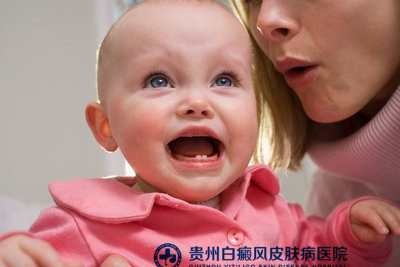 白癜风的症状 白癜风的症状