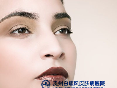 白癜风怎么及时诊断 白癜风怎么及时诊断