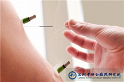 兰州有没有治疗白癜风好的医院
