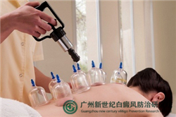 广州专治白癜风的医院有那些
