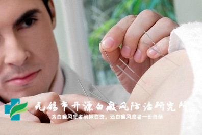 苏州哪家医院治疗白癜风最专业