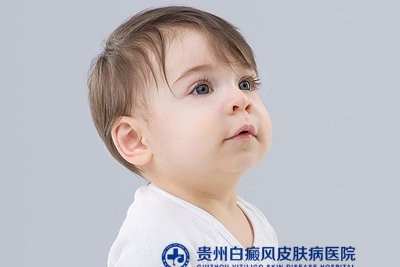 凯里哪家白癜风医院最好 凯里哪家白癜风医院最好