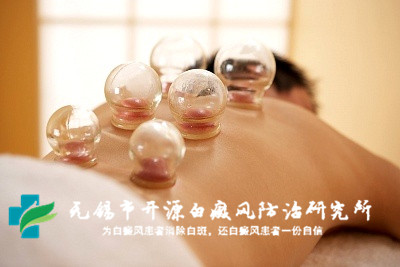 徐州哪家白癜风医院最好 徐州哪家白癜风医院最好