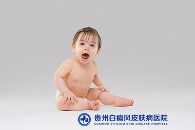 都匀哪家医院治疗白癜风最专业 都匀哪家医院治疗白癜风最专业