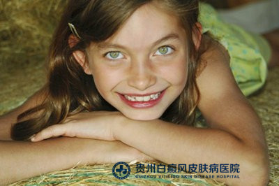 湘西白癜风 湘西白癜风