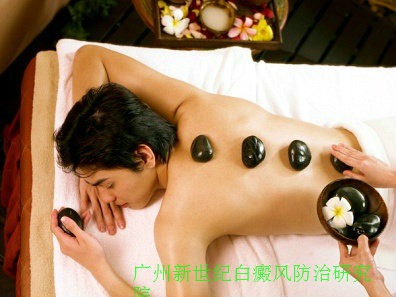 揭阳哪家看白癜风最好