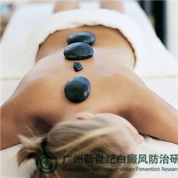 东莞白癜风医院最好的是哪家