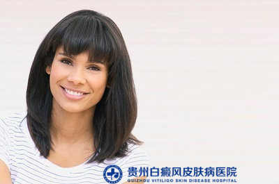 贵州哪所医院治疗白癜风好 贵州哪所医院治疗白癜风好