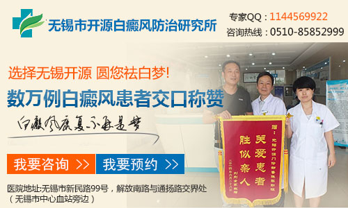 白癜风治疗无锡哪个医院最好