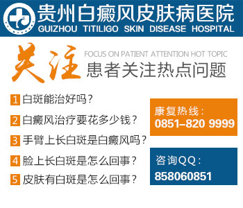 贵阳治疗白癜风最好医院是哪家 贵阳治疗白癜风最好医院是哪家