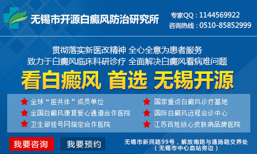 上海哪家医院治疗白癜风最专业 上海哪家医院治疗白癜风最专业