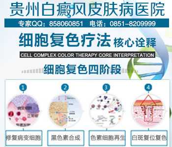 贵阳哪家正规医院治疗白癜风最好 贵阳哪家正规医院治疗白癜风最好
