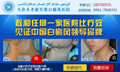 乌鲁木齐白癜风哪里医院治疗的比较好