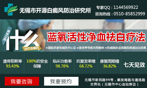 杭州白癜风医院最好的是哪家 杭州白癜风医院最好的是哪家