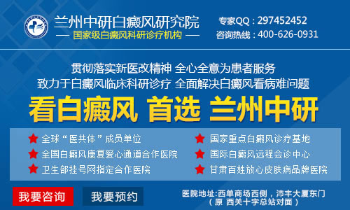 白癜风治疗兰州
