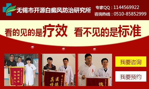 无锡治疗白癜风效果最好的医院是哪家 无锡治疗白癜风效果最好的医院是哪家