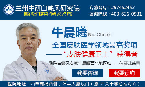 兰州治疗白癜风去哪家最好 兰州治疗白癜风去哪家最好