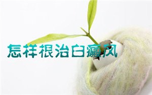手部白癜风有哪些症状 手部白癜风有哪些症状